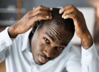 young african men hair loss 600nw 1905908287.jpg